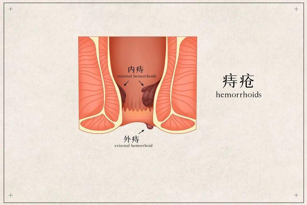 怀孕一个月肚子疼怎么办？停孕再孕交流圈为你详细解释