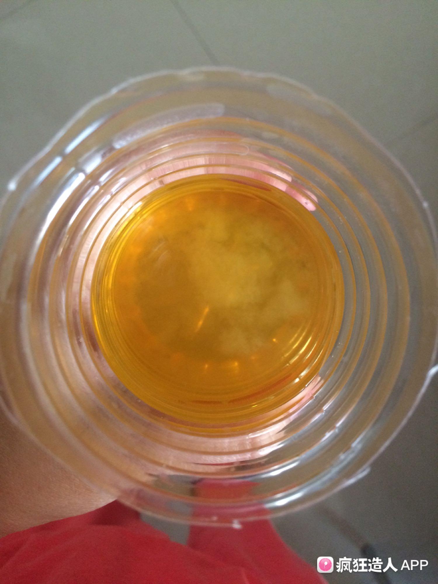 怀孕想知道胎儿性别？酒精测男女靠谱吗？