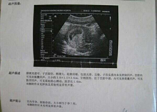 怀孕检查多久出结果？初期必做检查有哪些？
